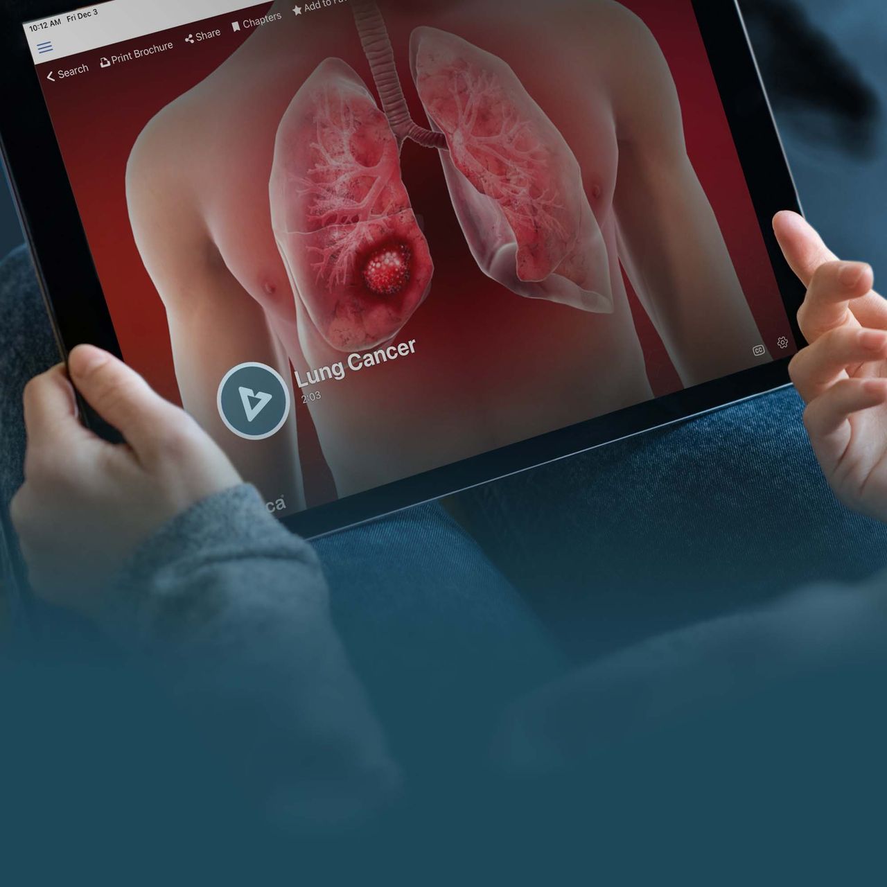 ViewMedica On-Demand brings patient education videos to your website and to macOS, iOS, Windows, and Android devices in your practice.