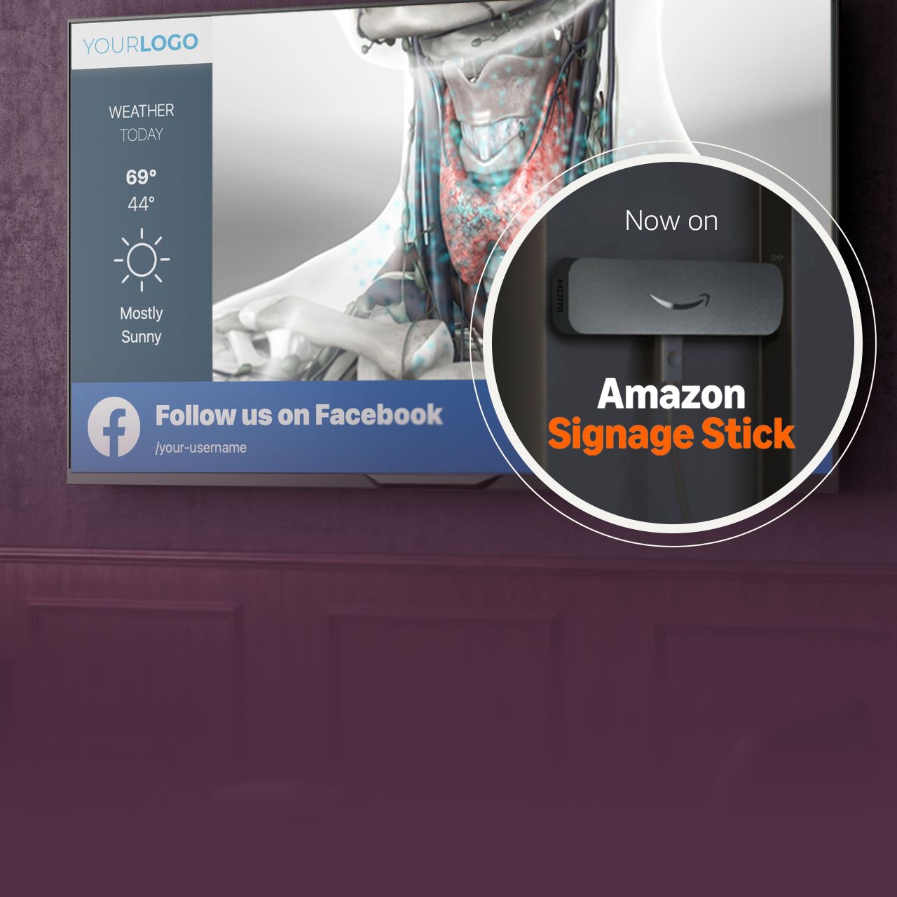 VMcast Healthcare TV brings medical patient education, practice messaging and more to your TV screens.