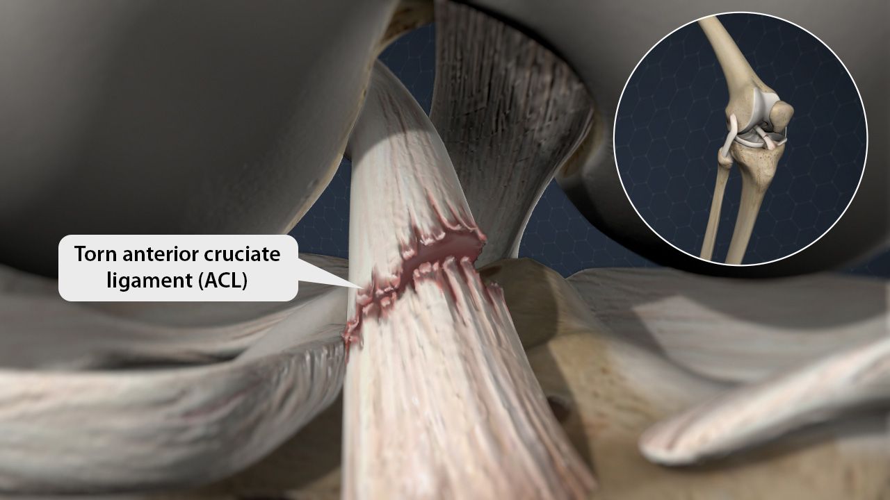 Clarify complex medical concepts