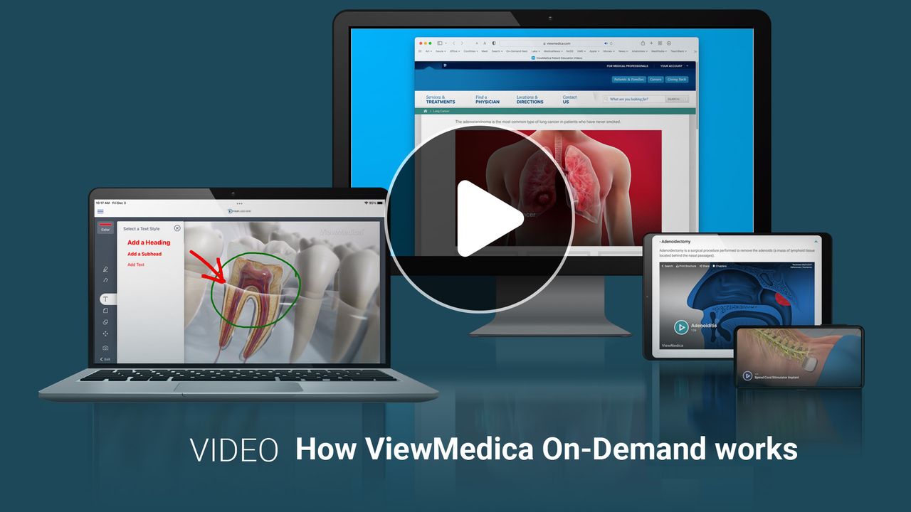 Patient Education Videos ViewMedica On-Demand