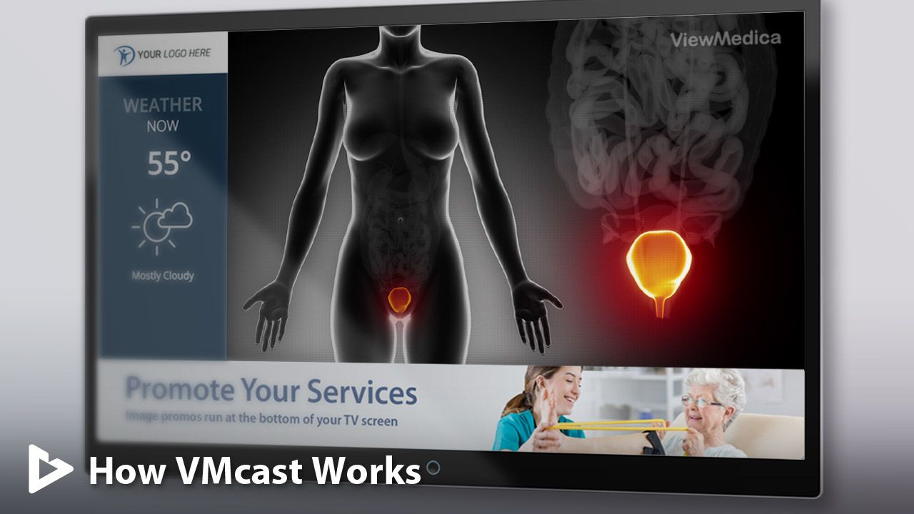ViewMedica VMcast Urology Patient Education Videos