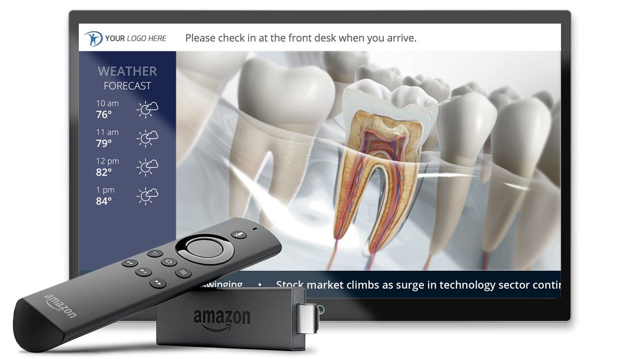 A VMcast setup can be a simple as wireless internet, a TV, and an Amazon Fire TV Stick.