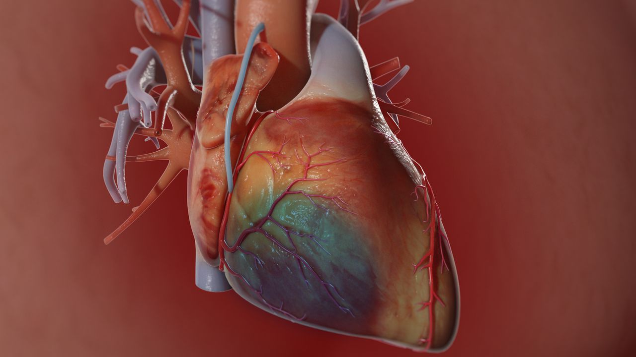 Coronary Artery Bypass Graft (CABG) | Cardiac Surgery | Michigan Medicine |  University of Michigan