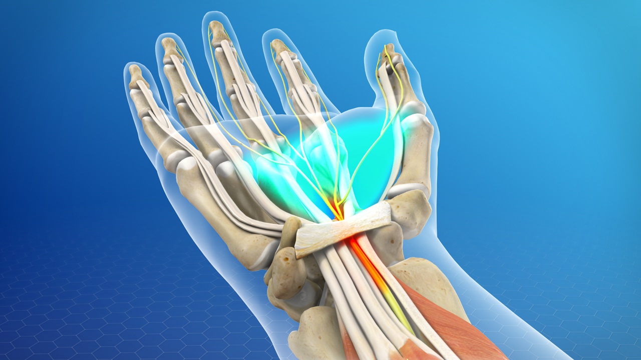 carpal tunnel syndrome wrist pain chiropractor mechanicsville chiropractic back pain neck pain