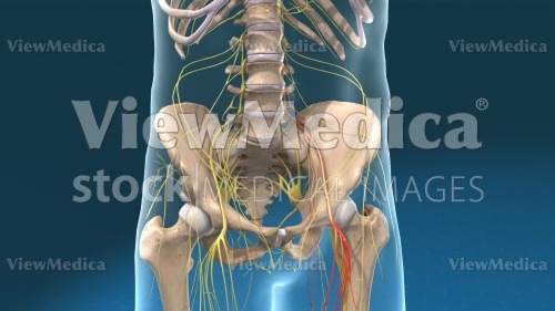 ViewMedica Stock Art: Painful nerve in back, thigh